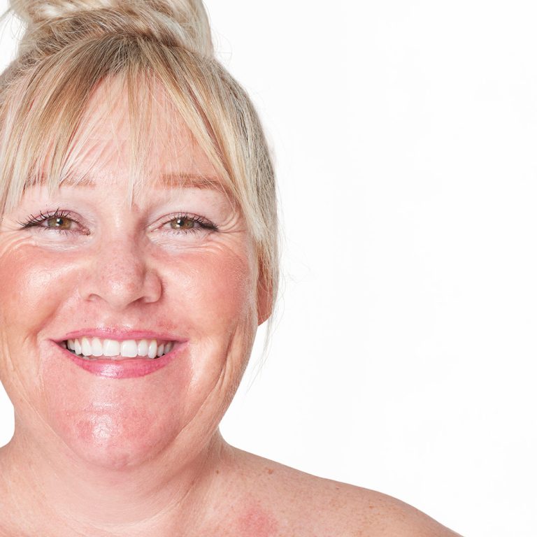 dermatologia-wroclaw-leczenie-tradzik-rozowaty-1